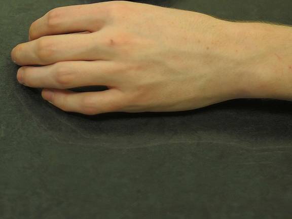 Heroin in our midst: Part 1 A recovering heroin addict, alias: "Ben," show his hand. Ben is now in his mid twenties he used the drug for roughly ten years.